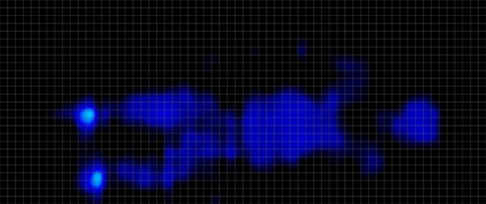 Helix Moonlight Luxe Pressure Map Stomach Helix Moonlight Luxe Pressure Map Stomach