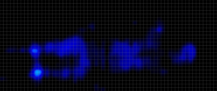 Helix Sunset Luxe Pressure Map Stomach Helix Sunset Luxe Pressure Map Stomach