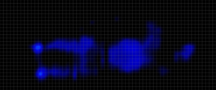 Helix Twilight Luxe Pressure Map Stomach Helix Twilight Luxe Pressure Map Stomach