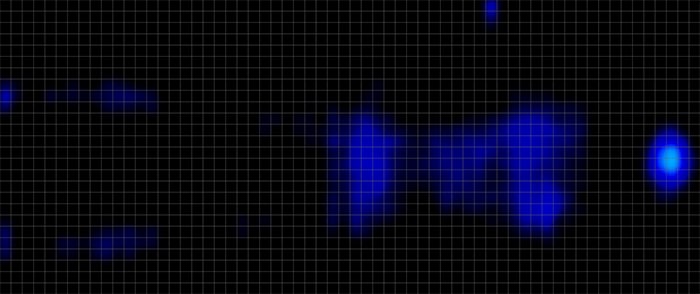 Ghostbed Signature Hybrid Pressure Mapping Back Ghostbed Signature Hybrid Pressure Mapping Back